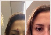 Cuidado de heridas y cicatrización