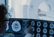 Por una deuda de IOMA corre riesgo la cobertura de tomografías y resonancias