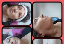 Estudio Profesional de Belleza Jimena Costoya informa: «Beneficios del HIFU»