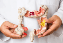 Charla abierta a la comunidad sobre prevención en alteraciones de colon