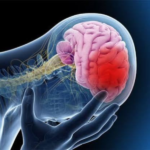 Realizarán una jornada de prevención de la salud cerebrovascular en el Hospital